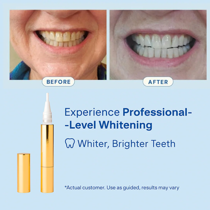 SnowGlow™ Whitening Pen (90% OFF TODAY ONLY)