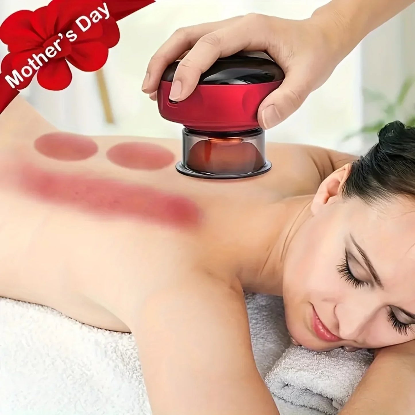 SuctionPro™ - Smart Cupping Massager